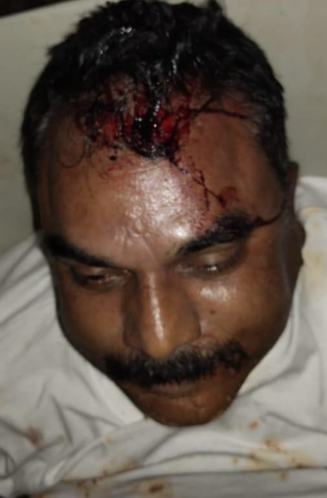 सोनभद्र में सड़क हादसा: अज्ञात वाहन की चपेट में आई कार, गाजीपुर के एसआई की मौत; पुलिस लाइन जाते समय हुई घटना चीफ़ ब्यूरो कमलेश पाण्डेय 8382048247 सोनभद्र में सड़क हादसा: अज्ञात वाहन की चपेट में आई कार, गाजीपुर के एसआई की मौत; पुलिस लाइन जाते समय हुई घटना चीफ़ ब्यूरो कमलेश पाण्डेय 8382048247