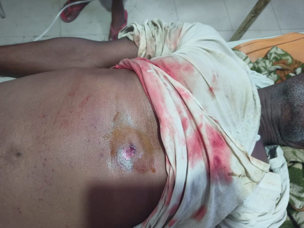 सोनभद्र: जमीनी विवाद में मनबढ़ों ने अधेड़ व्यक्ति पर चलाई गोली, हालत गंभीर सोनभद्र: जमीनी विवाद में मनबढ़ों ने अधेड़ व्यक्ति पर चलाई गोली, हालत गंभीर