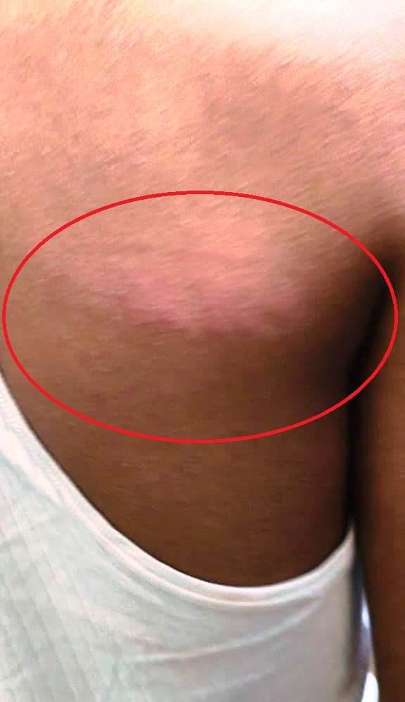बकाया फीस को लेकर प्रधानाचार्य ने 12वीं के छात्र की बेरहमी से किया पिटाई