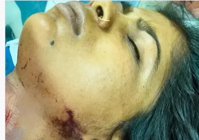 नहाने को कहा तो भड़क उठा पति, चाकू से पत्नी का गला रेता : 10 से ज्यादा टांके नहाने को कहा तो भड़क उठा पति, चाकू से पत्नी का गला रेता : 10 से ज्यादा टांके