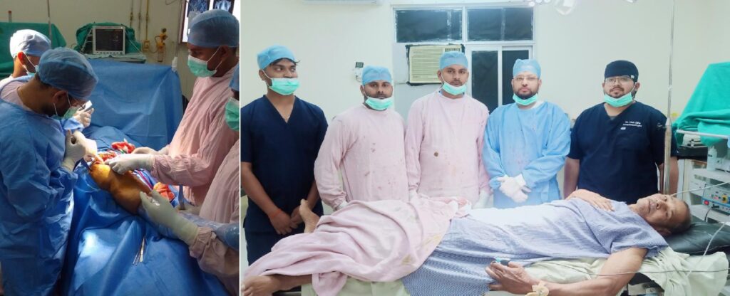 एपेक्स ट्रस्ट हॉस्पिटल, चुनार में रचा गया इतिहास पहली बार सफलतापूर्वक हुआ कूल्हा प्रत्यारोपण ऑपरेशन