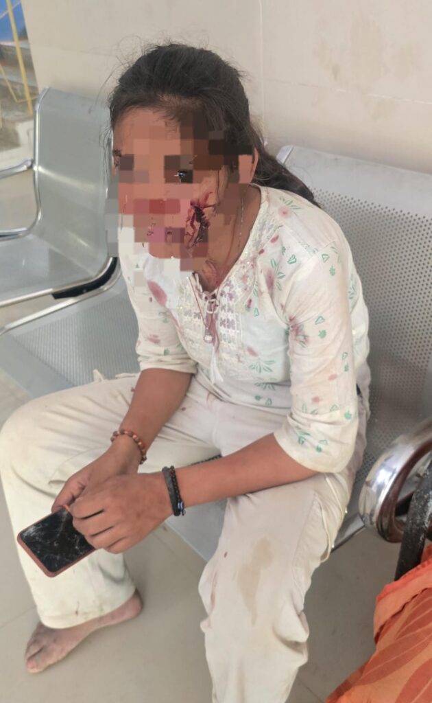 गाय के लिए छाजन बनाने को लेकर भड़का विवाद, दो पक्षों में जमकर मारपीट; महिला समेत कई घायल गाय के लिए छाजन बनाने को लेकर भड़का विवाद, दो पक्षों में जमकर मारपीट; महिला समेत कई घायल