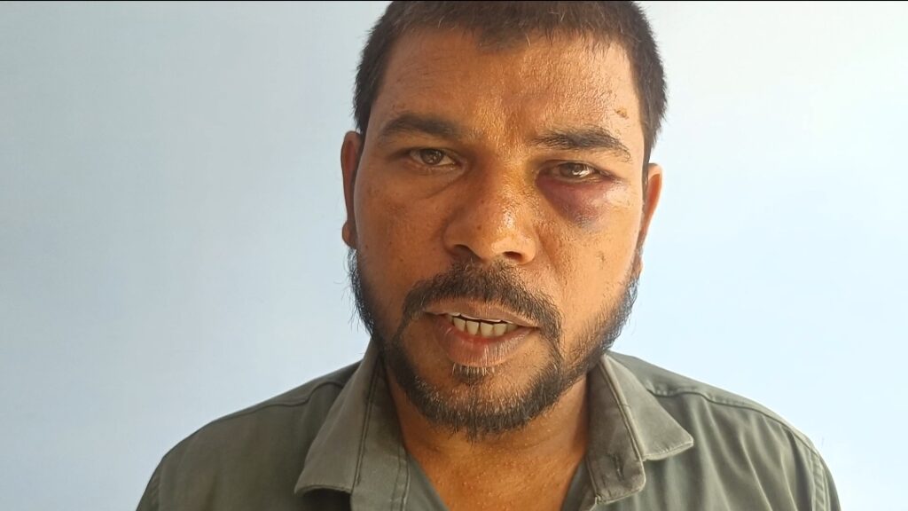 लोकतंत्र के चौथे स्तंभ पर प्रहार: मिर्जापुर के विंध्यवासिनी धाम में पुलिसकर्मी ने पत्रकार को बेरहमी से पीटा, व्यवस्था पर उठे गंभीर सवाल
