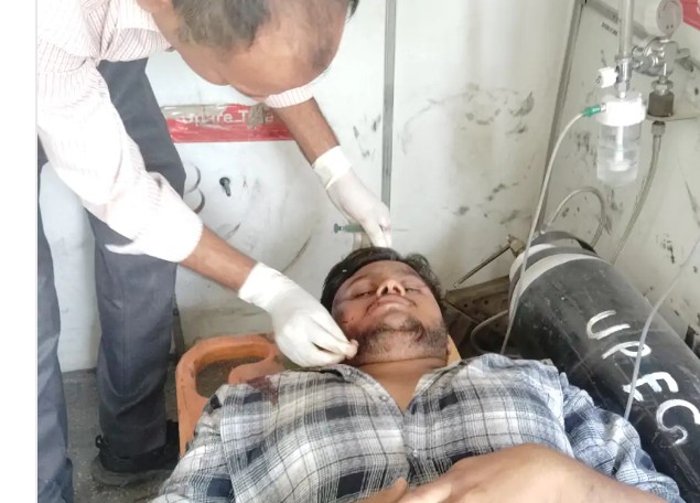 विंध्यधाम दर्शन को जा रहे दो युवक सड़क हादसे में गंभीर रूप से घायल विंध्यधाम दर्शन को जा रहे दो युवक सड़क हादसे में गंभीर रूप से घायल