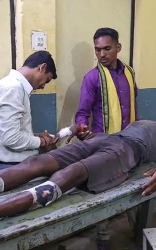 सोनभद्र: जादू-टोने के शक में युवक पर डंडे से हमला, गंभीर घायल; पुलिस जांच में जुटी