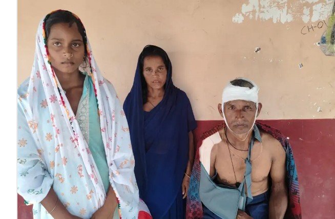 सोनभद्र: मेढ़ विवाद में सगे भाई ने परिवार संग किया हमला, दंपति समेत तीन गंभीर, वाराणसी रेफर सोनभद्र: मेढ़ विवाद में सगे भाई ने परिवार संग किया हमला, दंपति समेत तीन गंभीर, वाराणसी रेफर