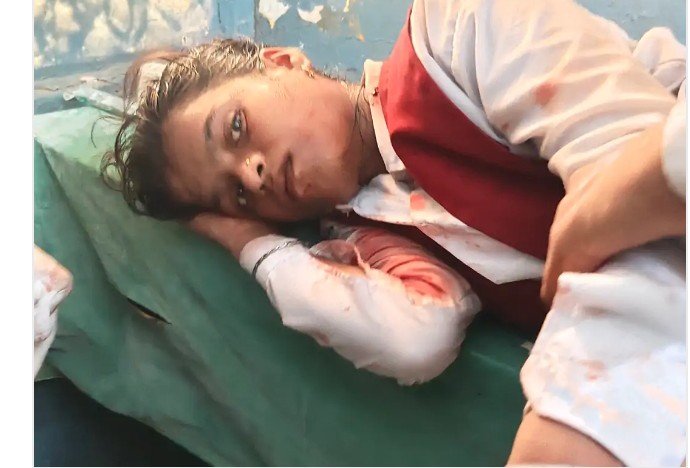 तेज रफ्तार बोलेरो की टक्कर से कक्षा 10 की छात्रा घायल, पुलिस ने चालक समेत वाहन कब्जे में लिया तेज रफ्तार बोलेरो की टक्कर से कक्षा 10 की छात्रा घायल, पुलिस ने चालक समेत वाहन कब्जे में लिया